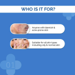 The Derma Co -BHA Gel for Active Acne - Image 3