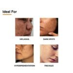 Fixderma 2% Kojic Acid + 1% Arbutin Skarfix-Plus Scar Removal Cream 15 g - Image 3