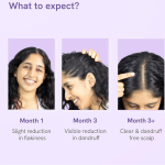 Be bodywise Anti Dandruff Scalp Serum