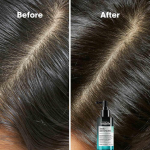 L'Oréal Professionnel Scalp