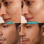 Pilgrim 10% Niacinamide Face Serum