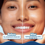 Aqualogica Barrier+ Hydra Gel Moisturizer