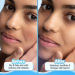 Aqualogica 5 Barrier+ Repair Moisturizer