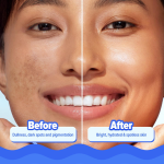 Aqualogica Bright+ Hydra Gel Moisturizer