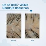 The Derma Co Triple Actives Anti-Dandruff Shampoo (200 ml) - Image 3