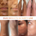 Vanish Gluta-Kojic Skin Polish