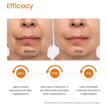 20% Vitamin C Face Serum