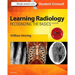 Learning Radiology