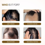 Hair Growth Serum Roll-On