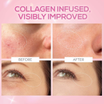 RENEE Pink Therapy Hydrolyzed