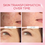 RENEE Pink Therapy