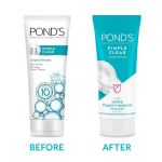 POND'S Pimple Clear