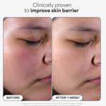PAULA'S CHOICE PERFECTING 2% BHA Liquid
