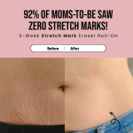 Cos-IQ Stretch Marks