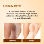 Fixderma Foobetik Foot Scrub Spray