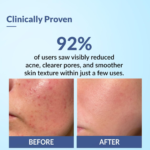 Fixderma Salyzap Face gel Moisturizer