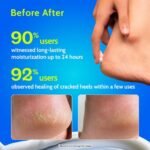 Chemist At Play Foot Cream for Cracked Heels 10% Urea & Natural AHAs Nourishment & Hydration For Dry & Cracked Feet– 50 g - Image 4