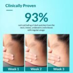 Fixderma Nigrifix Cream for Acanthosis Nigricans - Image 6