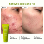 Conscious Chemist® 2% Salicylic Acid Cream