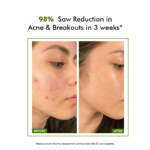 Conscious Chemist 2% Salicylic Acid Serum 
