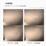 MediCube Zero Pore One Day Serum