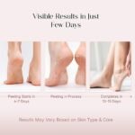 SeoulSkin Glycolic Acid Foot Peeling Mask