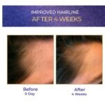 Streax Hair Growth Serum