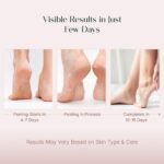 SeoulSkin Glycolic Acid Foot Peeling Mask (1 Pair) - Image 3
