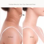 Seoulskin Kojic & Rice Water Brightening Soap For Dark Spots, Pigmentation & Underarm Brightening - Image 6