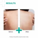 DERMATOUCH AHA 10% BHA 1% Body Lotion