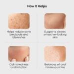 Cureskin Acne Control Gel