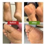 vilvah STORE Foot Cream For Dry And Cracked Feet 100 ml - Image 7