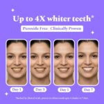 Perfora Purple Teeth Whitening Strips