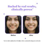 Perfora Purple Teeth Whitening Strips