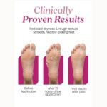WildGlow Korean Foot Hydration Mask