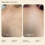 Arata 1% Salicylic Body Wash