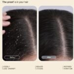 Arata Anti Dandruff Detox Combo Set