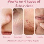 The Pink Foundry Acne Spot Corrector