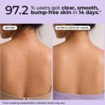 Hula Hoop 2% Salicylic Acid Exfoliating Body Wash