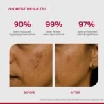 /PHD/ 2% Alpha Arbutin Depigmentation Serum