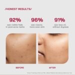 /PHD/ 10% Niacinamide Spot Correcting Serum